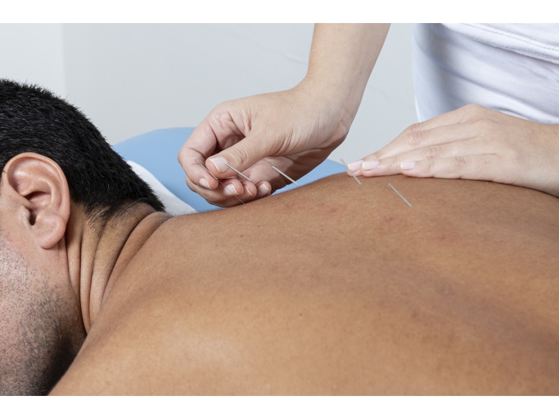 Acupuncture for Chronic Low Back Pain